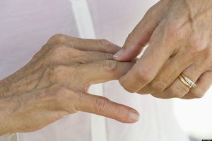 Артроз мелких суставов кистей рук