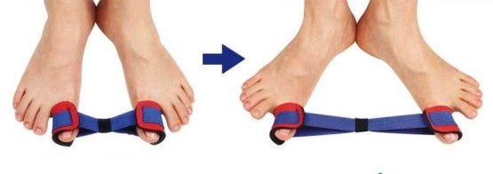 Лечение артроза большого пальца ноги гимнастикой