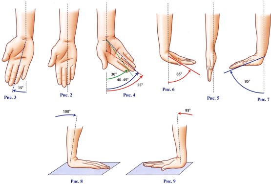 Разные углы поворота руки на разных стадиях артроза